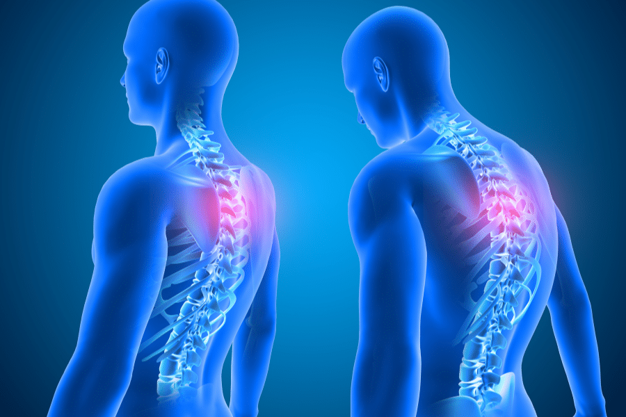Proven Techniques To Change Your Posture