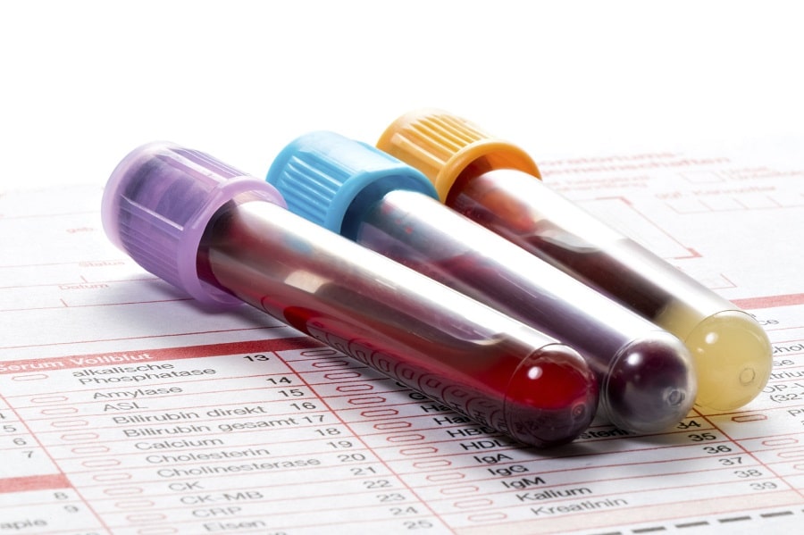 Understanding Your Blood Test Results