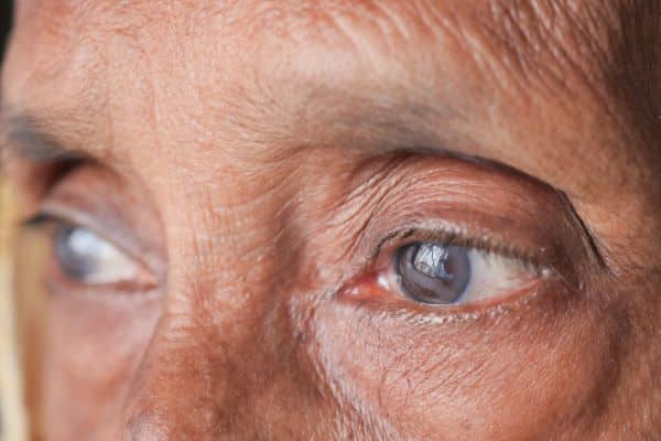 Eye Exams