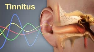 Everything You Need To Know About Tinnitus