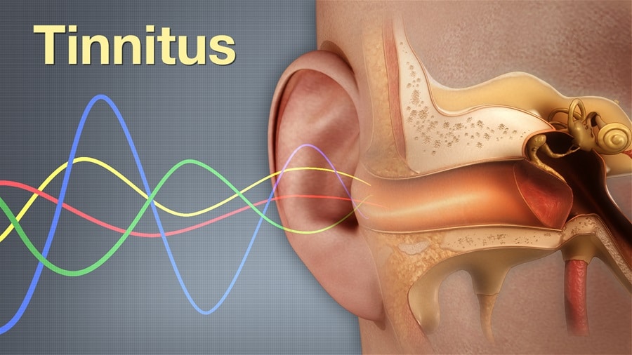 Everything You Need To Know About Tinnitus