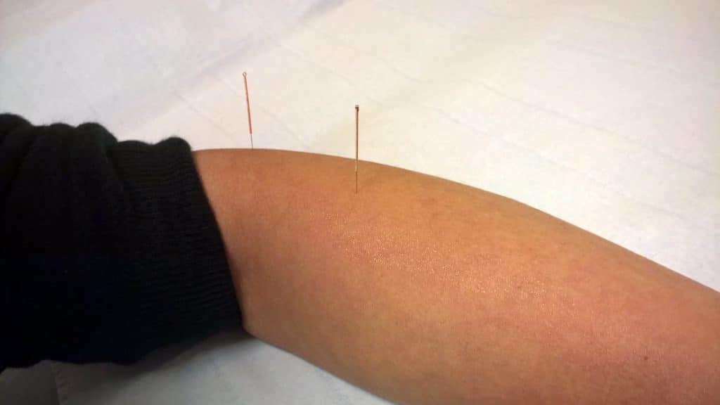 Helpful Tips for Managing Chronic Pain