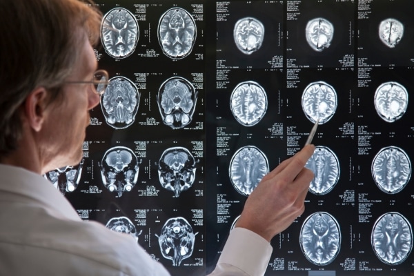 Can Nootropics Help Older Adults Stay Sharp?